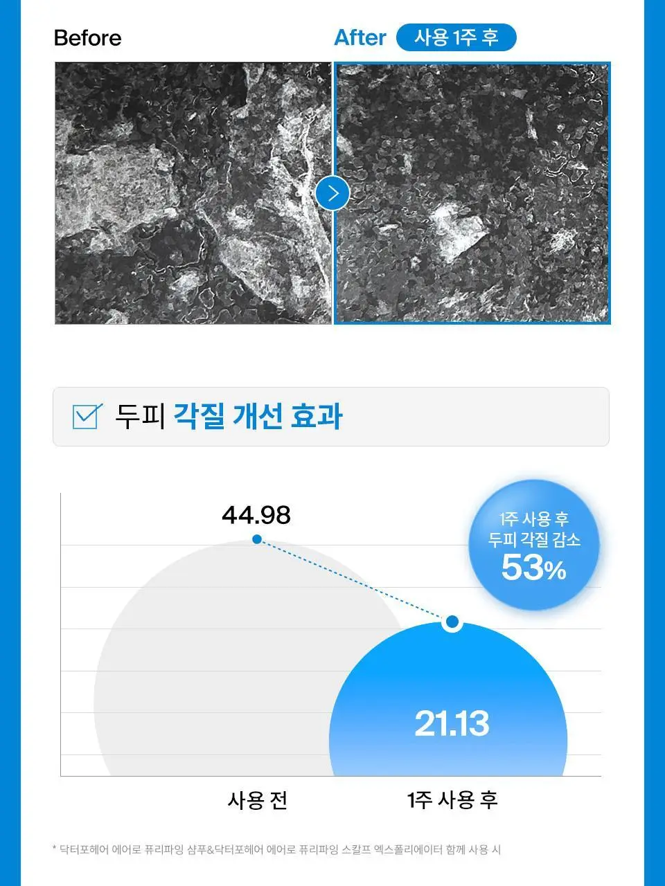 [NEW] 닥터포헤어 에어로 퓨리파잉 샴푸 500ml 상세페이지 10